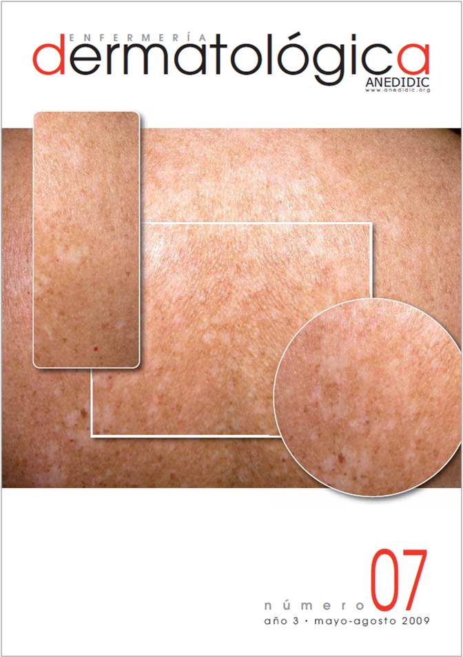 					Ver Vol. 2 Núm. 4 (2008): Enfermería Dermatológica (on line). 
				